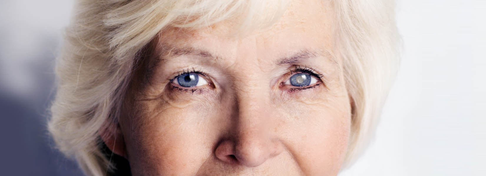 Cataract Surgery in Friendswood